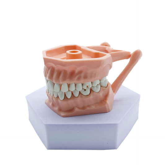 TIPODONTO ADULTO CON PREPARACIONES